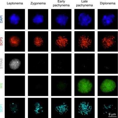 Immunocytochemistry/Immunofluorescence: SCP1 Antibody [Biotin] [NB300-229B] - Immunofluorescence staining of spermatocyte nuclei. Immunofluorescence images and signal quantification of stage-specific spermatocyte nuclei through meiosis prophase I. Details for signal quantification are described in Methods. Microscopic images are selected from two independent experiments in which two different combinations of primary antibodies are used; one using SCP3, H1t and SCP1, another one using SCP3 and STRA8. *Early and late pachytene nuclei cannot be unambiguously differentiated in the absence of H1t staining, and are therefore merged for counting and signal quantification. Image collected and cropped by CiteAb from the following publication (//www.nature.com/articles/s41467-019-11820-7), licensed under a CC-BY license.